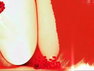 RED EROTICS