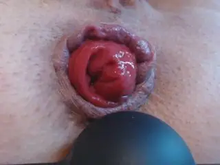 Anal play and prolapse play HD