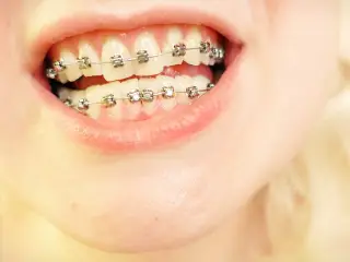 braces mouth tour video - vore fetish