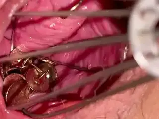 Put a thumbtack in your pussy and stir it with a whisk
