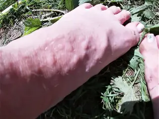 Feet Whipping With Itchy Nettles