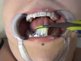 Dentist Probes Naughty Girl's Mouth