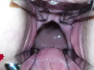 The mistress' cunt is opened with a hole expander so that you can study her cervix.